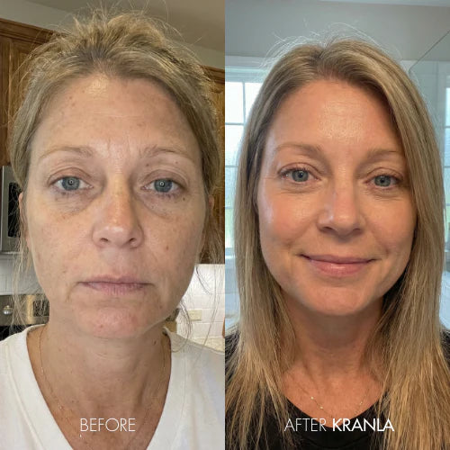 Emily W. - Age 57