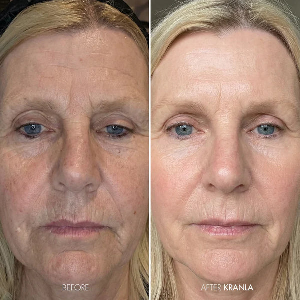 Ashley B. - Age 61