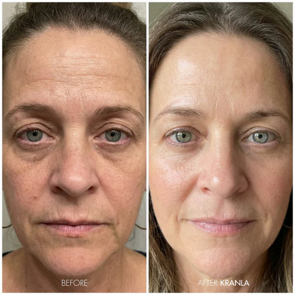 Amanda L. - Age 58